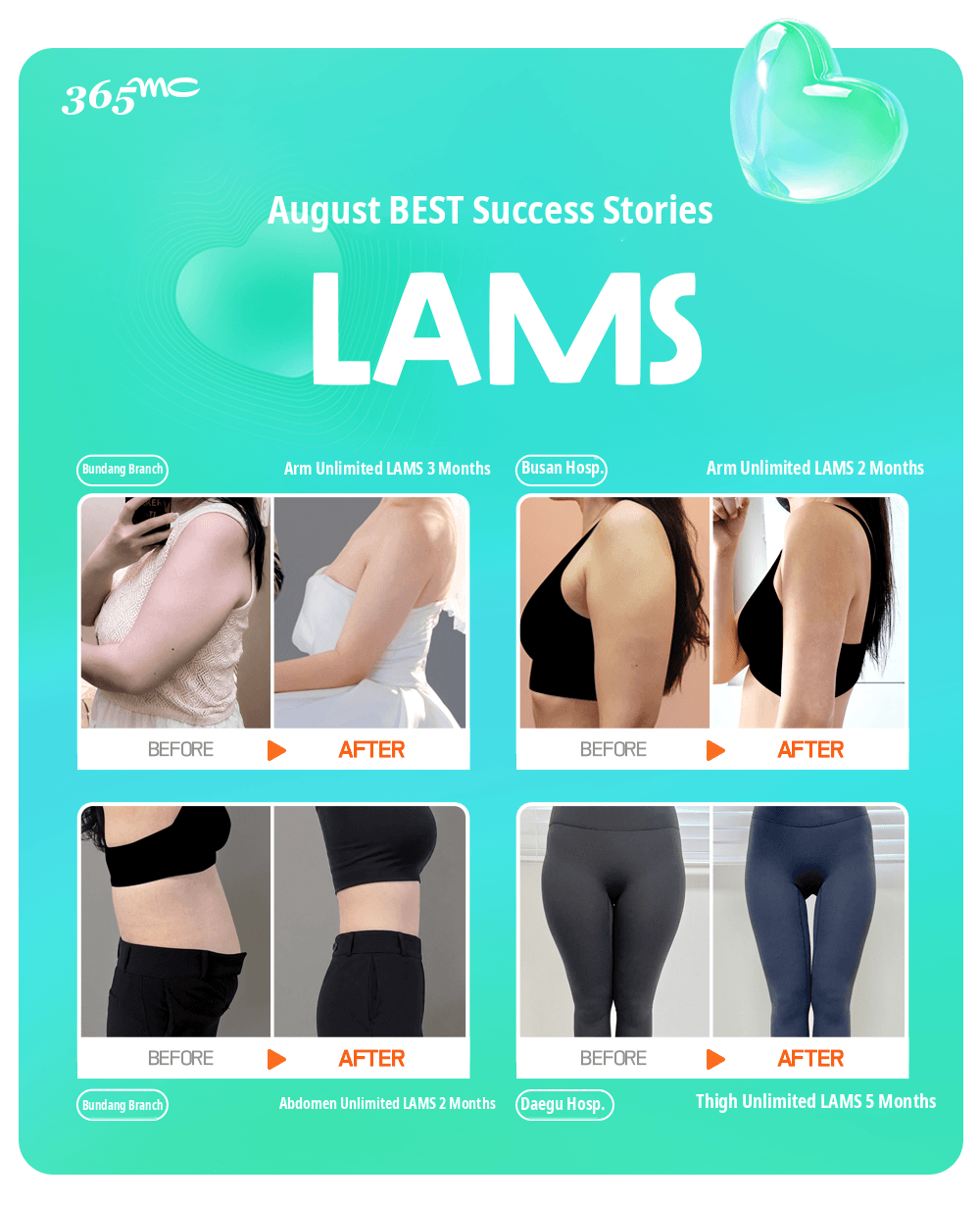 Four before and after Unlimited LAMS results from 365mc clinics in August