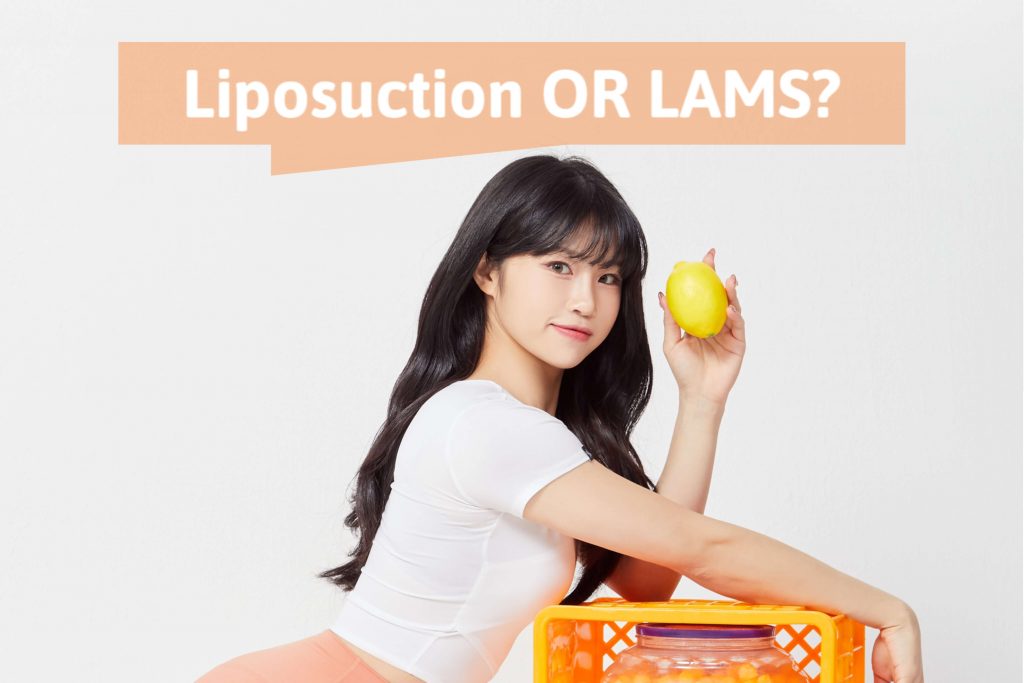 Liposuction and LAMS Differences