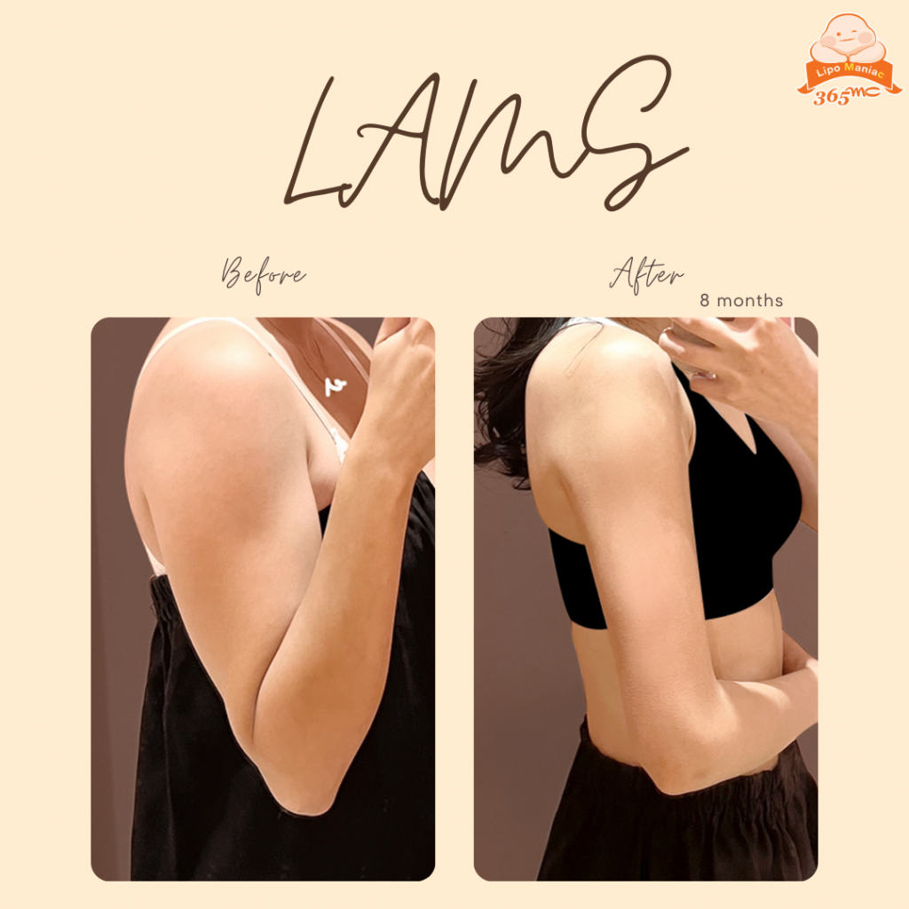 ARMS LAMS