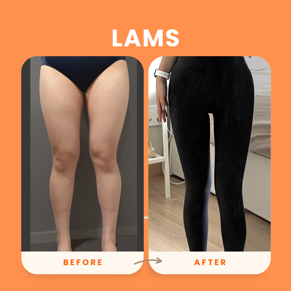 [IMAGE 2 LAMS]